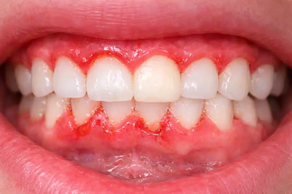 common dental problems