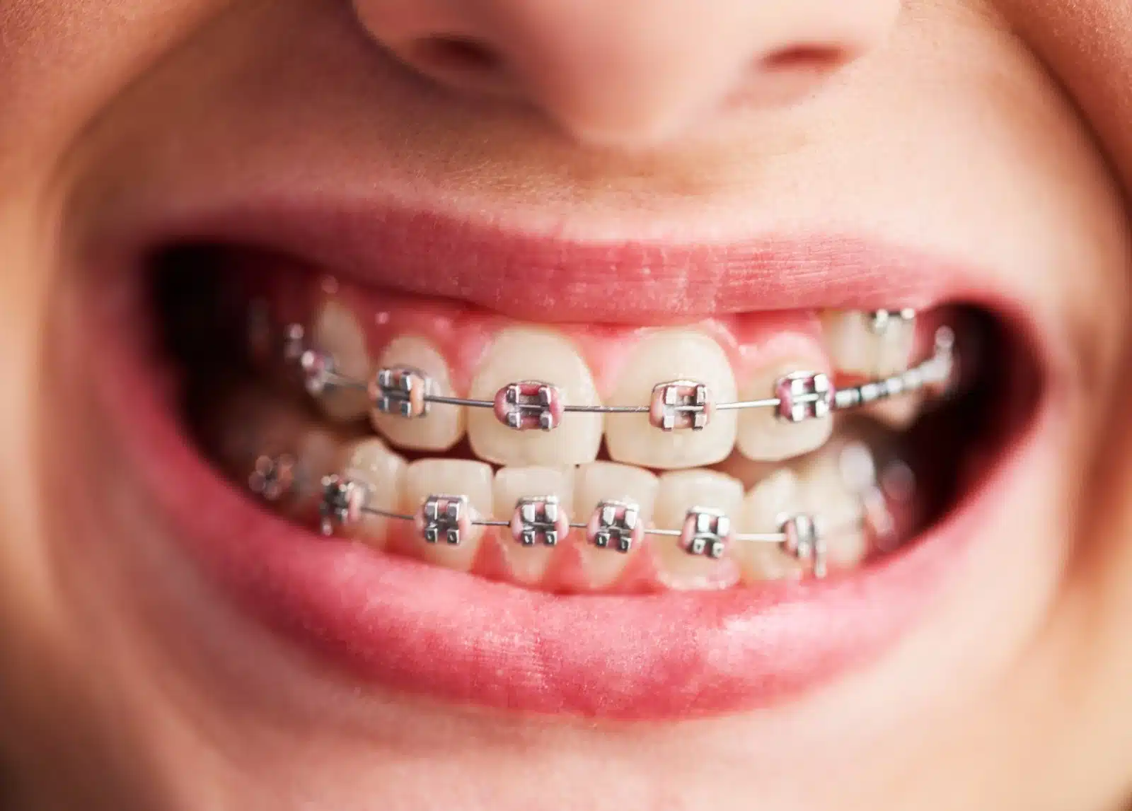 Best dental clinic in UAE