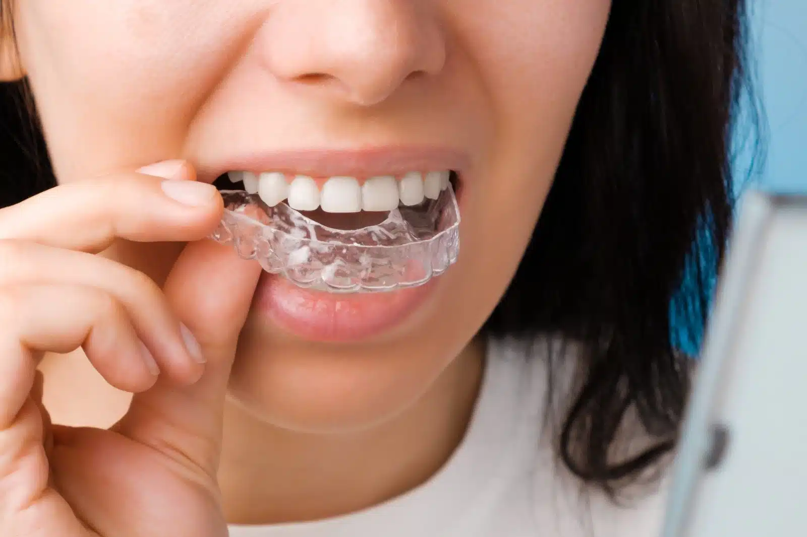 Best dental clinic in UAE
