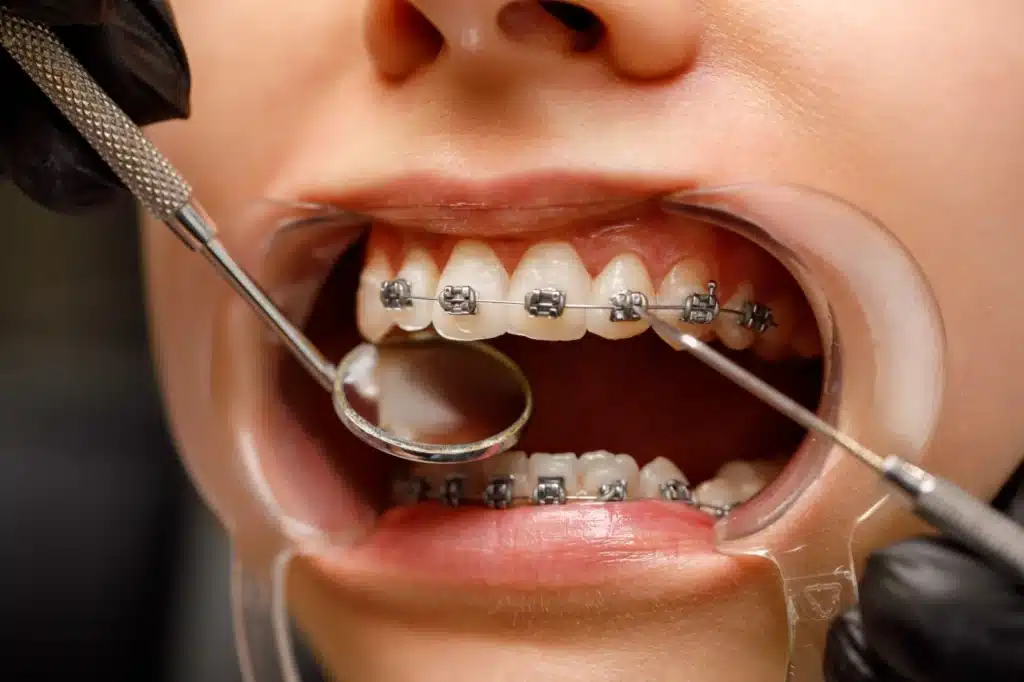 Orthodontist in Kannur