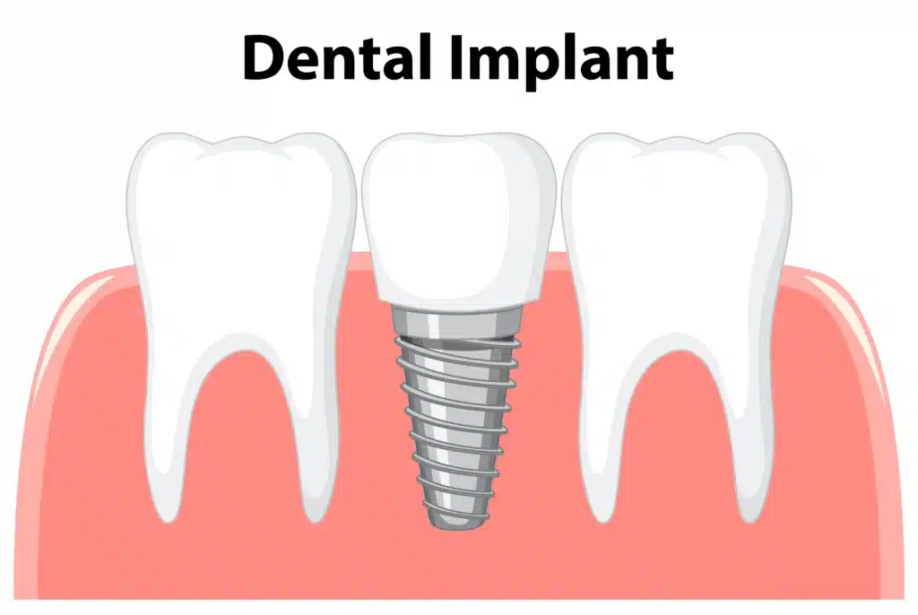 Why International Patients Choose Kerala for Dental Treatments