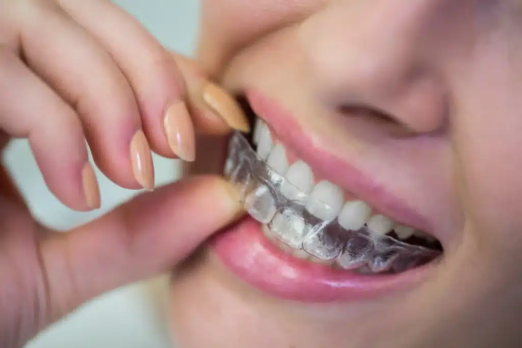 Why International Patients Choose Kerala for Dental Treatments