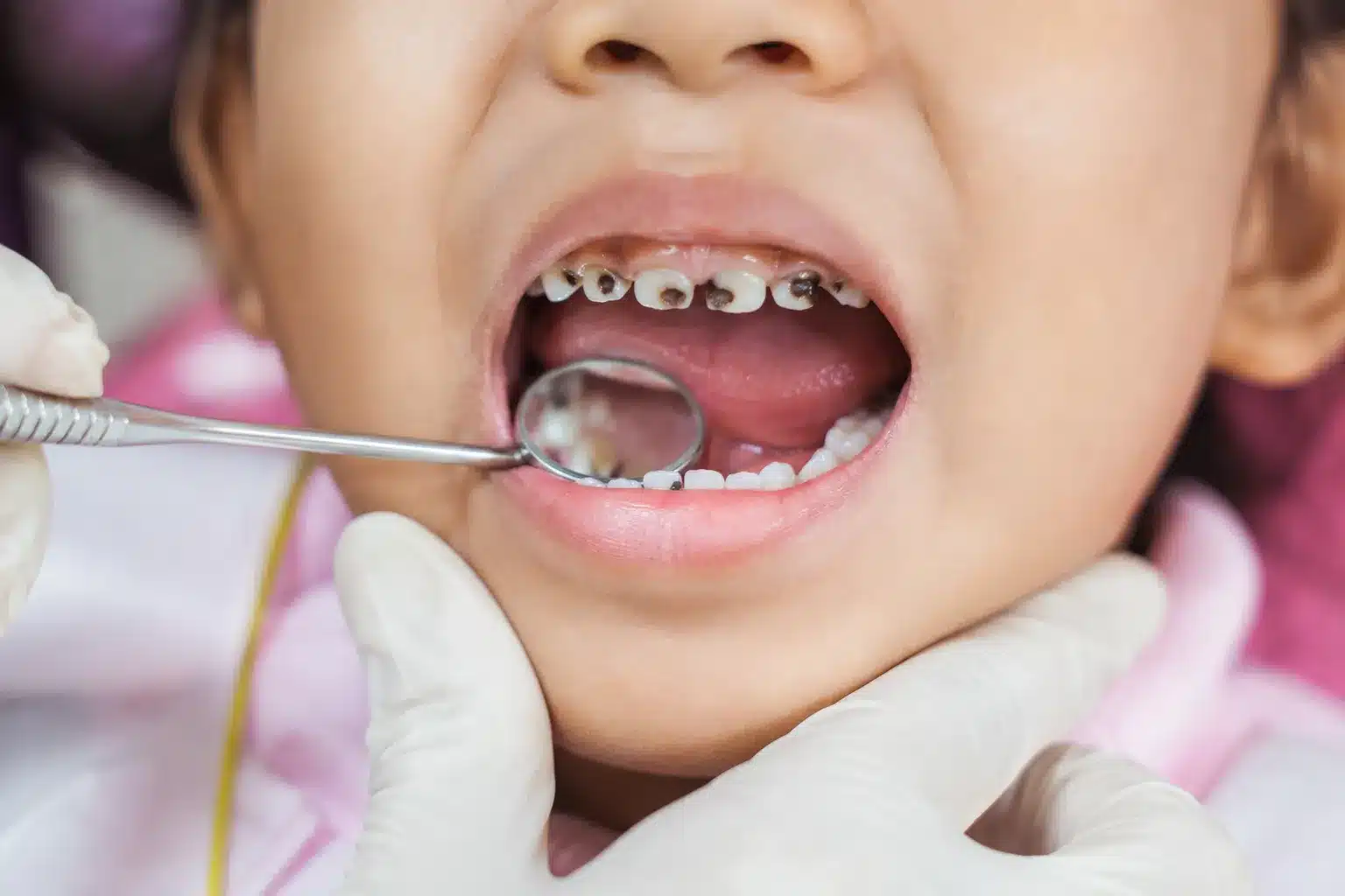 Best dental clinic in calicut